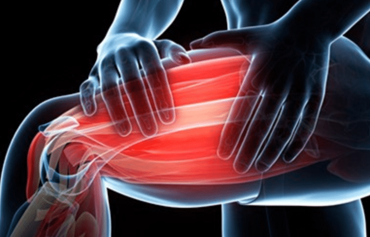 Everything You Need To Know About Delayed Onset Muscle Soreness (DOMS) »  UESCA