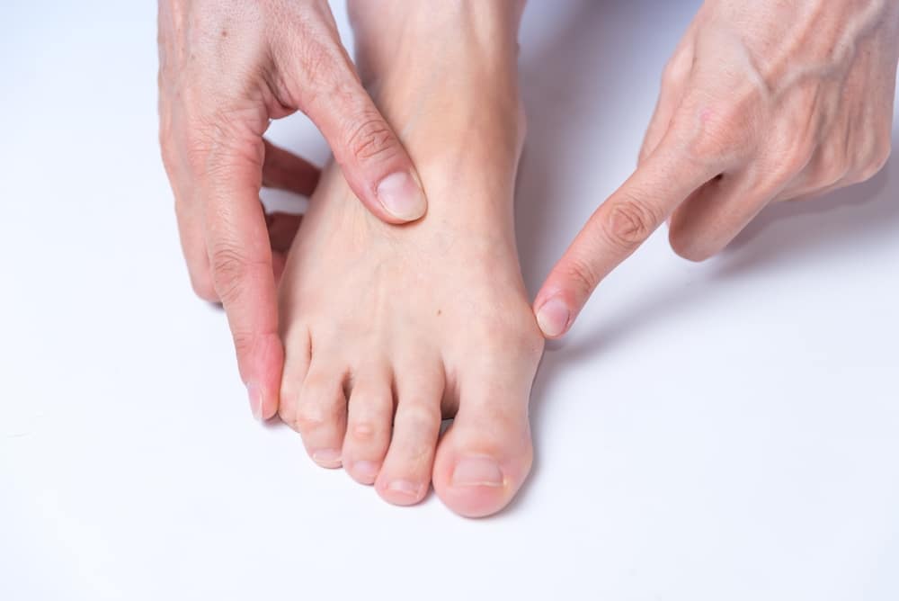 A human foot with a bunion